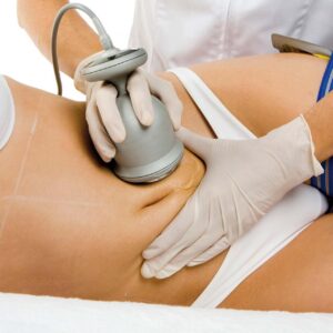 Cavitación (5 sesiones)