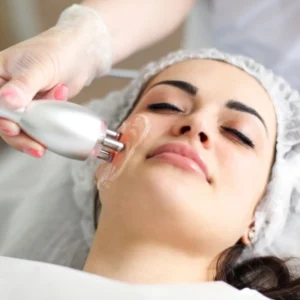 Radiofrecuencia facial